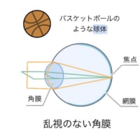 日本コンタクトレンズ学会② 乱視の矯正