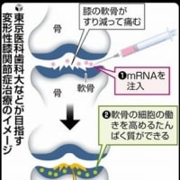 高齢化で膝が痛い人に朗報！