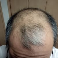 育毛剤　vol.2
