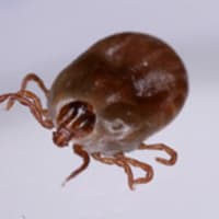 マダニ媒介ウイルス感染症など