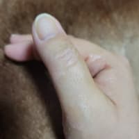 2021/11/08  ドセタキセル副作用!! 