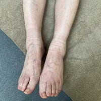 患者さんが訴えるのは一か所ではない