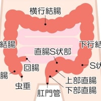 大腸ポリープについて