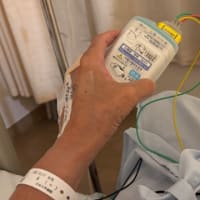 プレート抜去手術