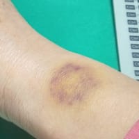 足首ではなく、手首です・・・(*´艸`*)