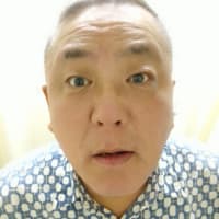 完治症例　重度顔面神経麻痺6０代男性　佐山様