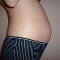 お腹の写真 前ならえ お腹の写真 前ならえ