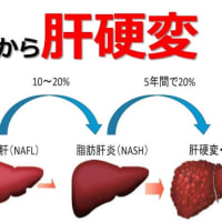 脂肪肝NASH 肝臓の謎