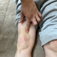 患者さんが訴えるのは一か所ではない