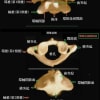 解剖モデル画像の連載