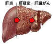 肝臓の仕組み