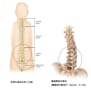 側弯症による脊椎のねじれを表す図