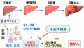 大阪・漢方『肝臓癌』大腸癌・胃癌・腎癌。ドラッグフタバ（豐多葉堂漢方）