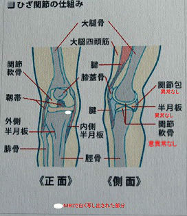 膝の痛みの原因がわかる ライフスタイル自由人
