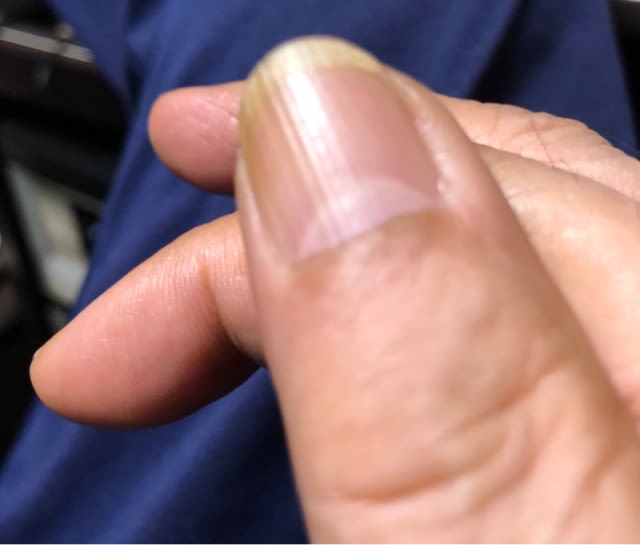 シワの数なんて トム小西