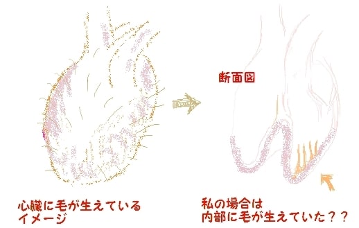 いもりん人間ドックで 心臓に 要精密検査 結果編 いもりんのヒルズ的生活 貧乏昔話