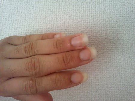 爪伸びすぎた Darknesshadecraw 爪伸びすぎた Darknesshadecraw