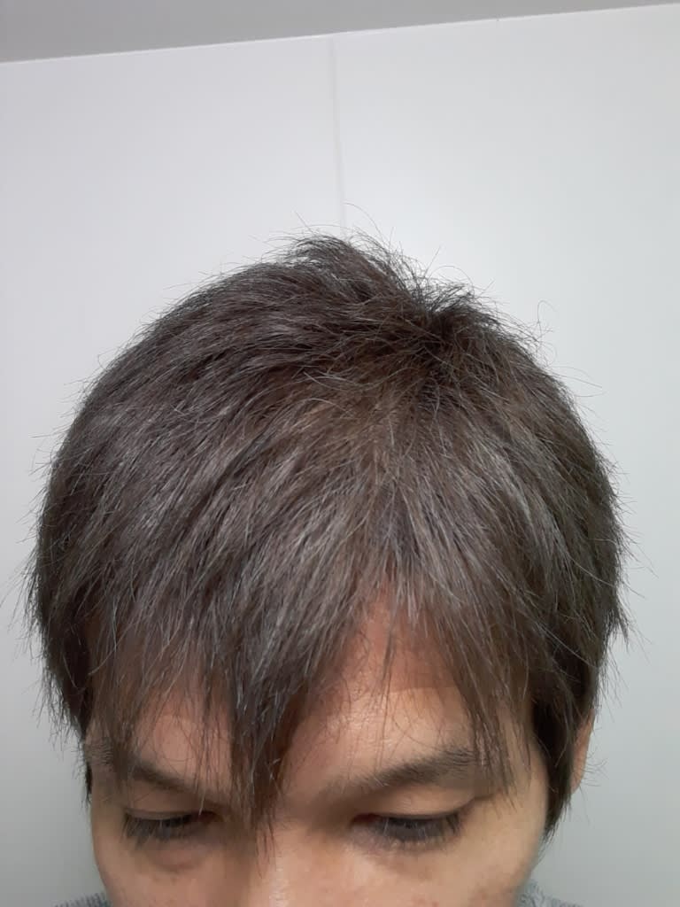 市販のカラー剤でグレーヘアに挑戦 カラー後4日経過 岩崎貴典のgooブログ