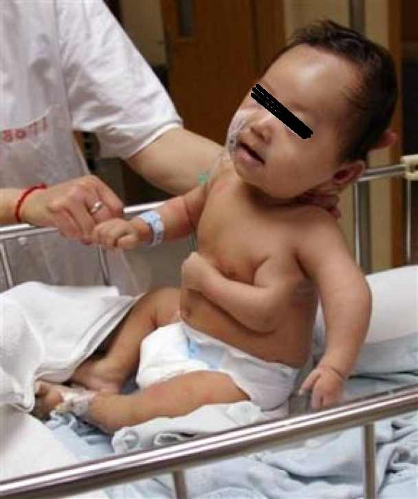 現在の福島 奇形児出産 の割合が極めて高い 福島の とある病院 妊婦の８０ が奇形児出産 政府 社会の問題 提言など