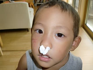 鼻ティッシュデビューした太郎 苦笑 一姫二太郎の放牧日記 鼻ティッシュデビューした太郎 苦笑 一姫二太郎の放牧日記