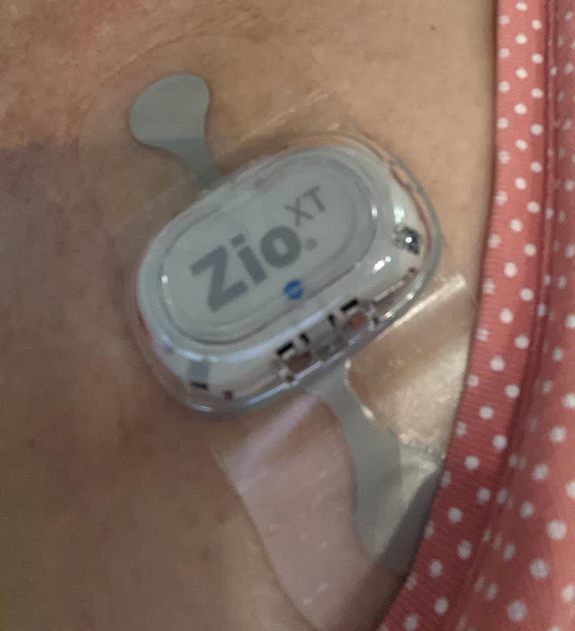 14日間ECGモニター ZIO® XT Patch 歩行用着用型パッチ ハワイで元野犬とセミリタイア生活