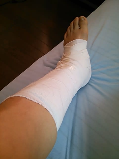 靭帯損傷 優稀ちゃん 優奈の徒然ノート 靭帯損傷 優稀ちゃん 優奈の徒然ノート