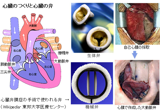 心臓弁膜症を完治せよ 整形医療と再生医療で 拒絶反応なし Yes We Love Science