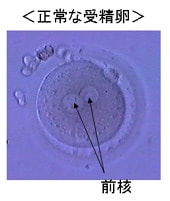 出産予定日 胚盤胞