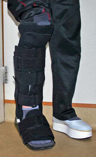 アキレス腱断裂19日目 ギブスが外れる 北の国のpanchanのブログ アキレス腱断裂19日目 ギブスが外れる 北の国のpanchanのブログ