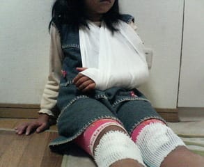ゆぴ 骨折 ワンだふるlife ゆぴ 骨折 ワンだふるlife
