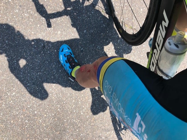 くるぶし ひび 自転車に乗