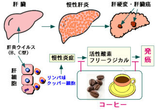 肝 コーヒー 脂肪 脂肪肝の原因は○○だった！ 脂肪肝はこうすれば必ず治る