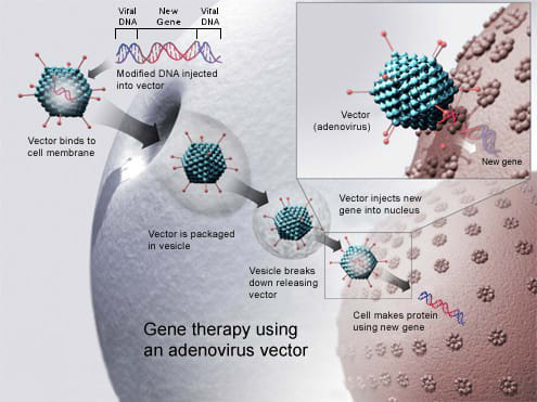 Genetherapy Genetherapy