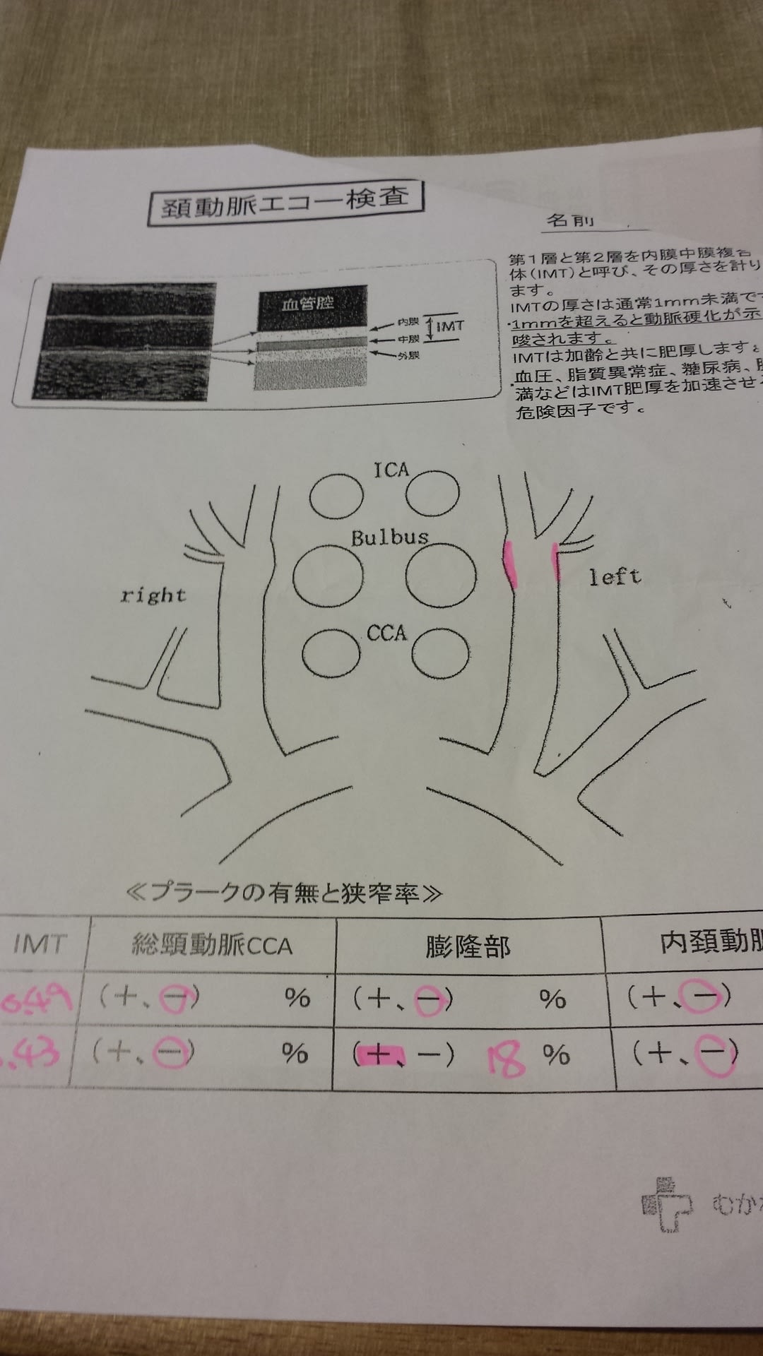 頸動脈狭窄エコー検査 うっさの独り言ーー日本刀大好きオヤジのひとりごと 頸動脈狭窄エコー検査 うっさの独り言ーー日本刀大好きオヤジのひとりごと