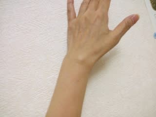 手首に軟骨みたいなのが出る 素 す ブログ 手首に軟骨みたいなのが出る 素 す ブログ