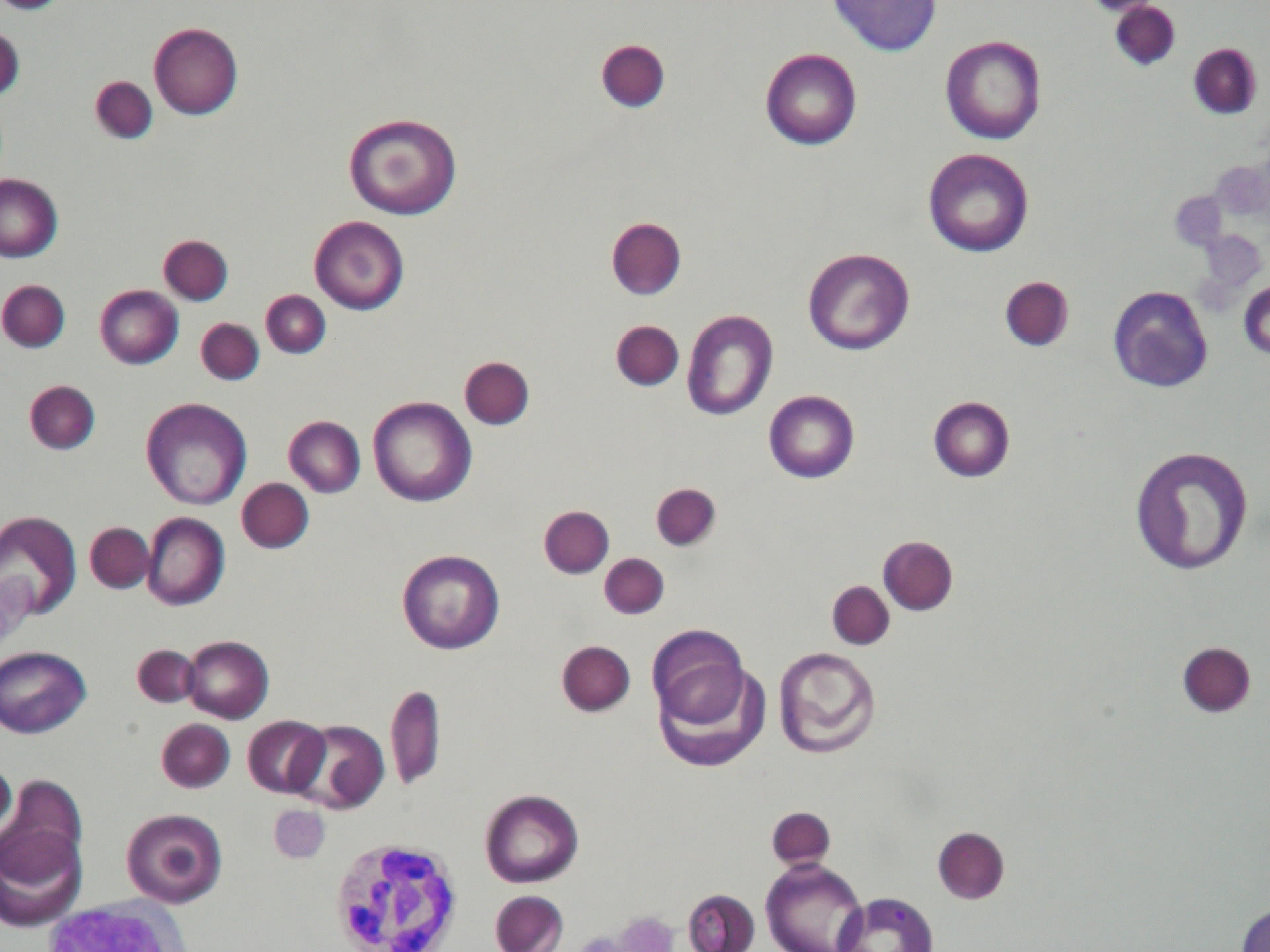 免疫介在性溶血性貧血(IMHA) 王子ペットクリニック 免疫介在性溶血性貧血(IMHA) 王子ペットクリニック