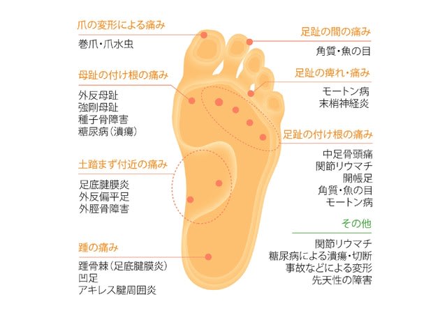 足の親指 母趾 の痛み 外反母趾 横浜元町 平塚のドイツ健康靴とmbt専門店 赤い靴のブログ