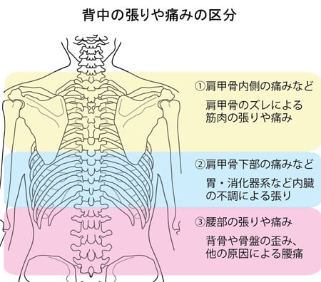 背中の張りや痛み 肩甲骨下部の張りや痛み からだ について考えます