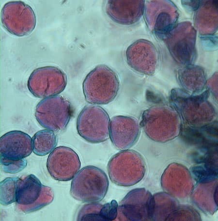 梅の花粉 各種顕微鏡写真でがってん 花 動物の写真のペ ジgoo
