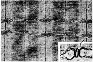 カエル縫工筋縦断切片電子顕微鏡像