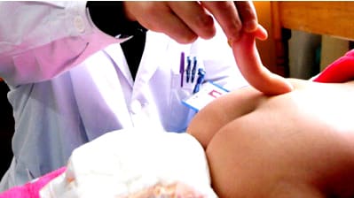 しっぽ の生えた人間の赤ちゃん誕生 切除手術に成功 アマチュア無線局 Ja2kowの苦 好 戦的奮戦記
