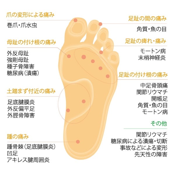 関節リウマチ の記事を作成中 横浜元町 平塚のドイツ健康靴とmbt専門店 赤い靴のブログ