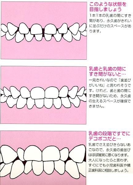 乳歯列の年齢 ３歳 ５歳 の理想の歯並びについて 宮川歯科医院 院長ブログ