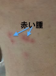 突然に帯状疱疹 頭部 になってしましました 急性期 わん子の命 突然に帯状疱疹 頭部 になってしましました 急性期 わん子の命