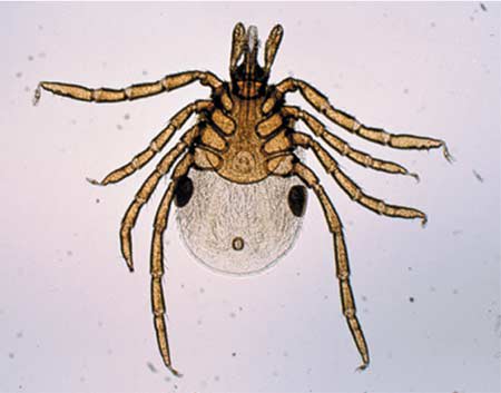 新型インフルエンザ・ウォッチング日記～渡航医学のブログ～New illness spread by ticks found similar to Lyme disease