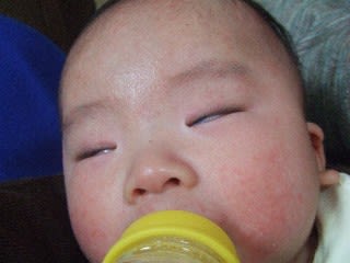 白目 ふうせんかずら